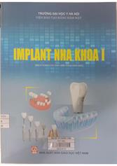Implant nha khoa 1 : Sách dùng cho sinh viên Răng Hàm Mặt