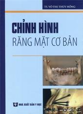 Chỉnh hình răng mặt cơ bản