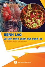 Bệnh lao và tiến trình chấm dứt bệnh lao (Tài liệu giảng dạy cho sinh viên y khoa)