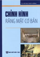 Chỉnh hình răng mặt cơ bản