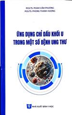 Ứng dụng chỉ dấu khối U trong một số bệnh ung thư /