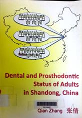 Dental and prosthodontic status of adults in shandong, china