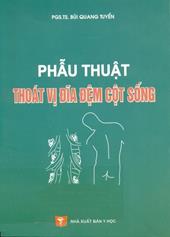 Phẩu thuật thoát vị đĩa điệm cột sống