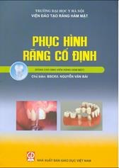 Phục hình răng cố định :