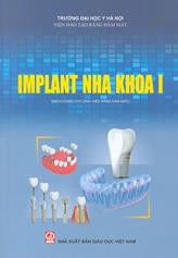 Implant nha khoa 1 :