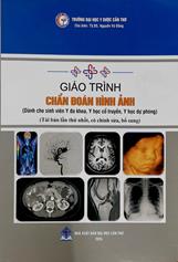 Giáo trình Chẩn đoán hình ảnh :