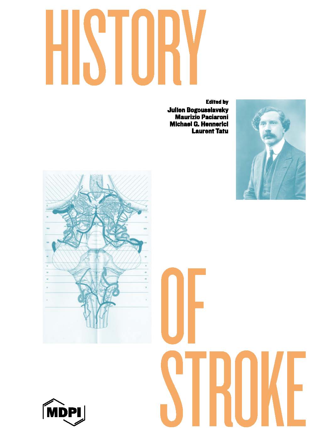 History of Stroke